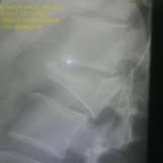 Ramon Carliste Profile Picture