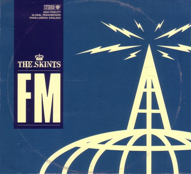 FM