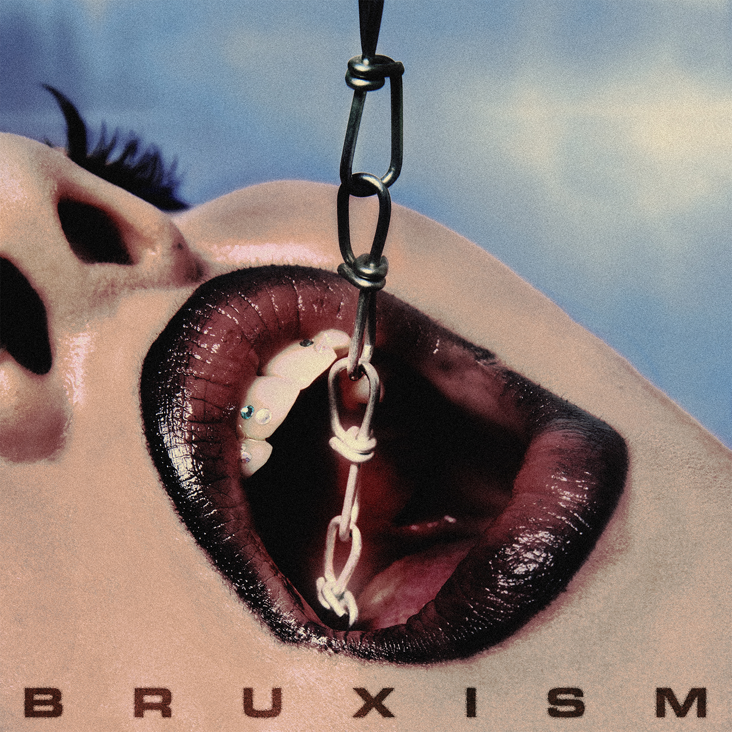 BRUXISM