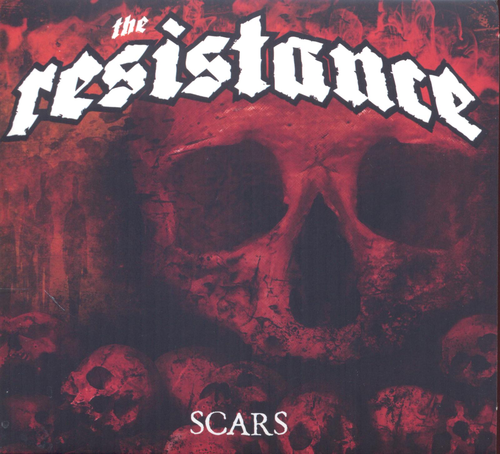 Scars