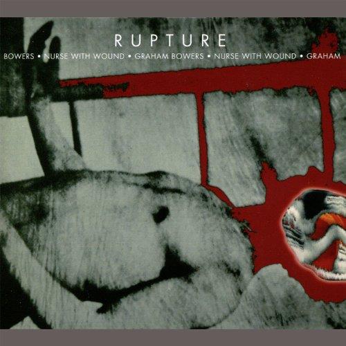 Rupture