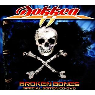 Broken Bones